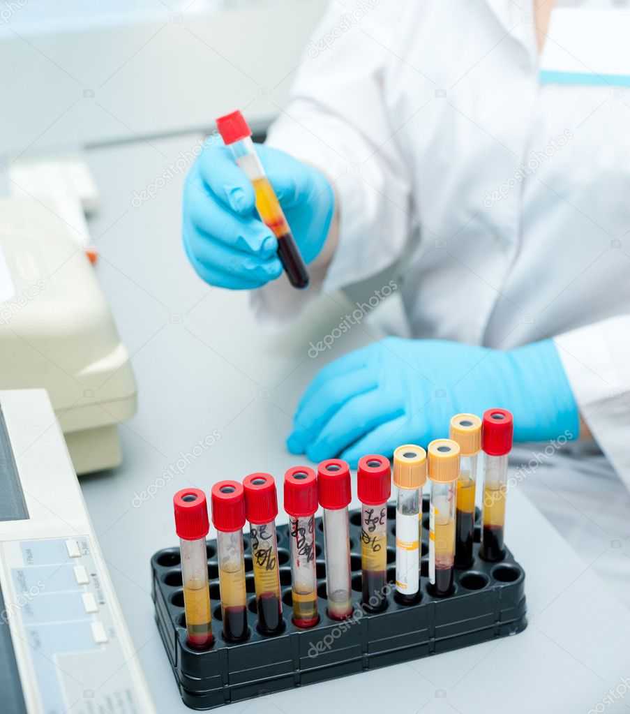 depositphotos_12140884-test-tubes-with-blood.jpg