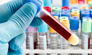 Сколько действительны анализы крови и мочи